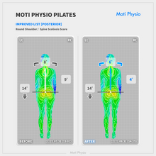 Load image into Gallery viewer, Dual EMG electrodes (210 pieces)
